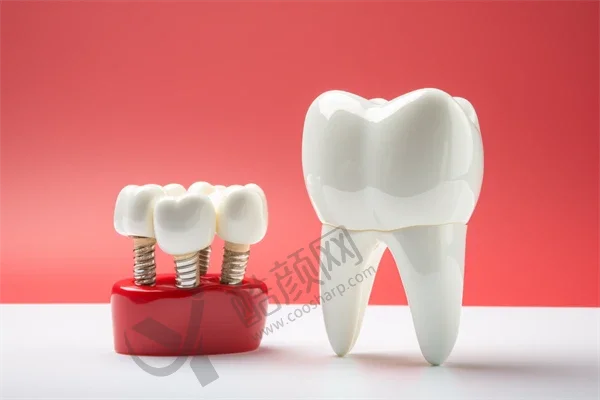更新！香坊区人民医院牙科价目表发布，医生介绍、种牙术后反馈！