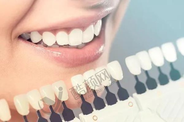 上海瑞伢美口腔诊所瑞士进口全瓷贴面价格1380/颗起，有效改善牙齿颜色