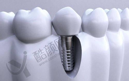 长春传阳口腔的医生团队与技术优势