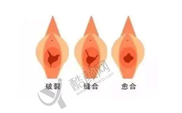 上海美联臣整形医院做私密整形好