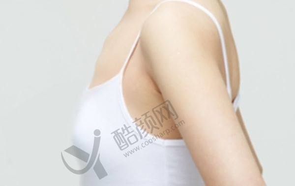 成都后美医院做缩胸手术怎么样