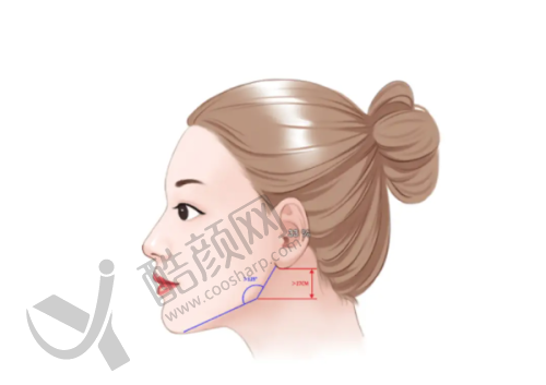 成都八大处唇腭裂修复医生介绍
