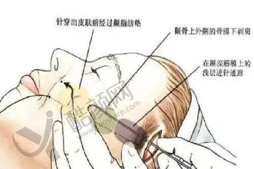 七、沈阳名流整形美容医院真实的患者评价如下：