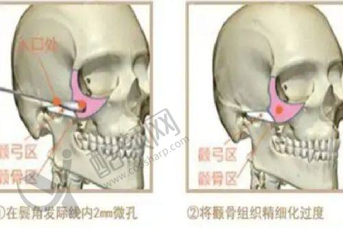 六、茂名茂美美容医院真实的患者评价如下：