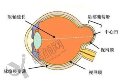 聊城华厦眼科医院于瑞云医生半飞秒手术价格 9800 元起，经验丰富口碑好别错过 