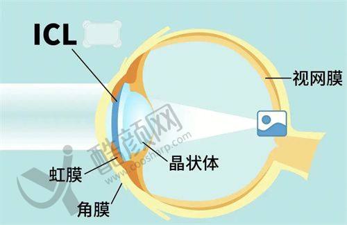 五、广州佰视佳眼科医院怎么预约：