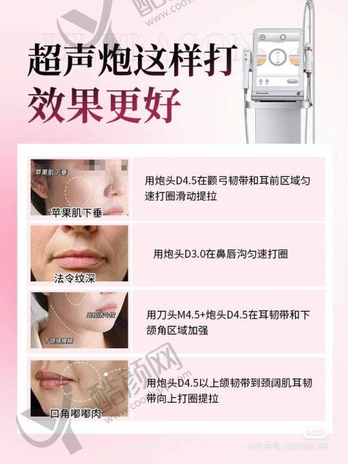 杭州艺星医疗美容医院:连锁品牌,实力不凡