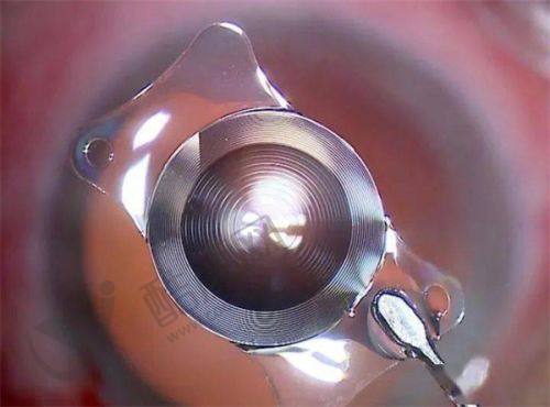 七、广州梓沁医疗美容门诊部真实的患者评价如下: