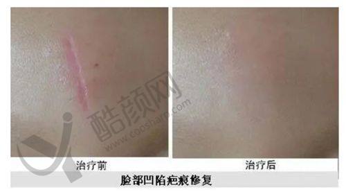 六、广州梓沁医疗美容门诊部价格表:(仅供参考)