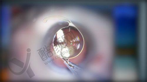 四、武汉何氏精益眼科怎么预约：