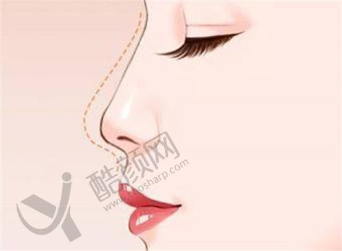 三、广州梓沁医疗美容门诊部医生介绍: