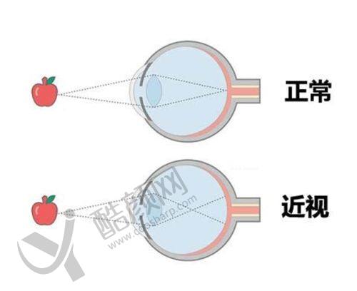 一、武汉何氏精益眼科怎么样？