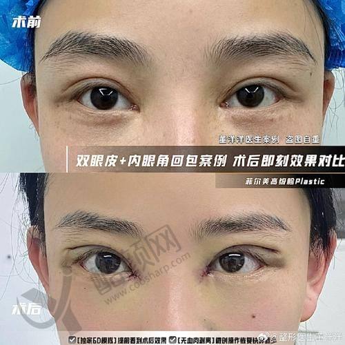 五、温州韩美整形医院怎么预约：