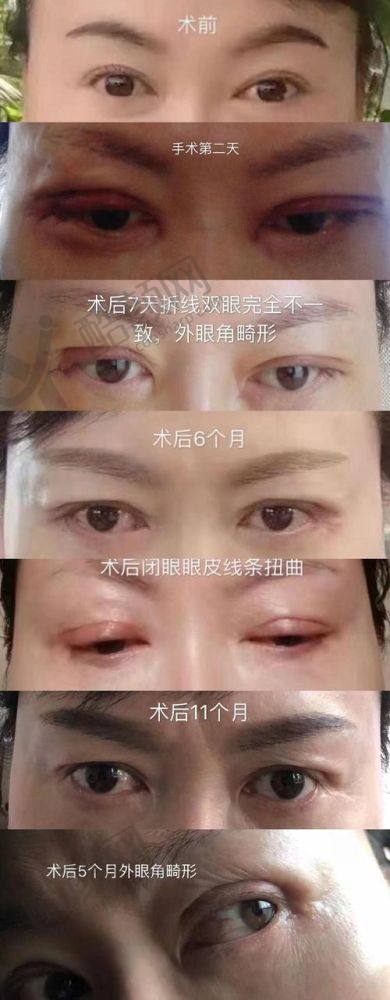 一、温州韩美整形医院怎么样？