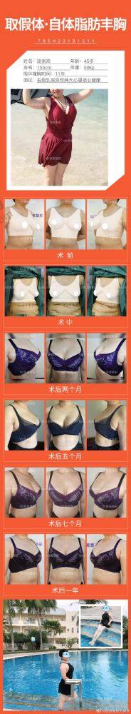 七、温州韩美整形医院真实的患者评价如下：