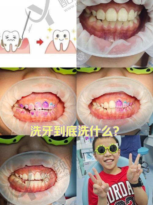 一、贵州省人民医院口腔科怎么样？