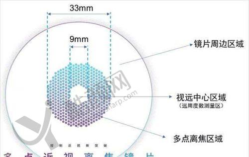 一、保定鹰华眼科医院怎么样?
