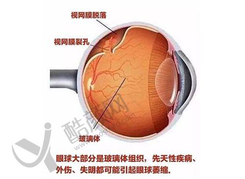 一、银川进川眼科医院怎么样？