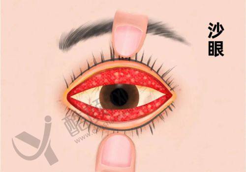 六、保定鹰华眼科医院价格表:(仅供参考)