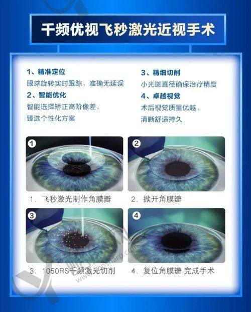 一、沈阳爱尔卓越眼科医院怎么样？