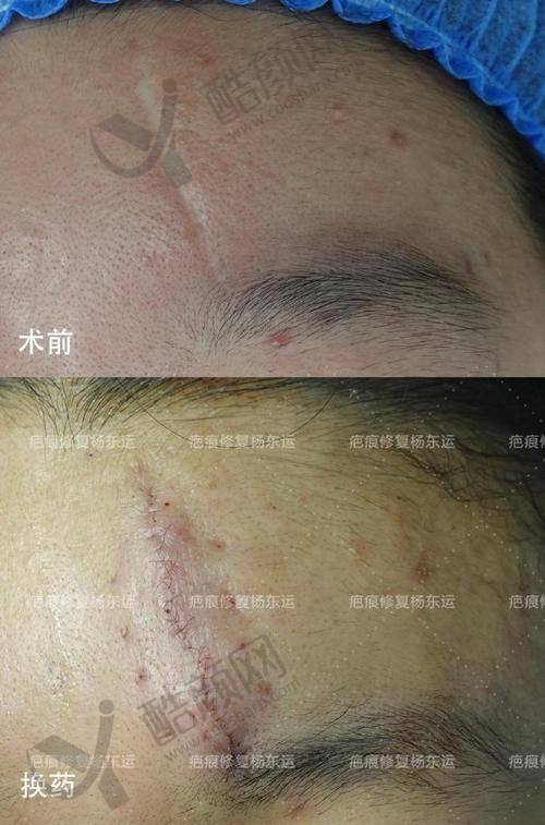 白永辉医生修复价格表