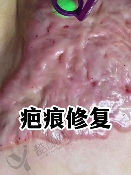 白永辉医生擅长项目及技术特点