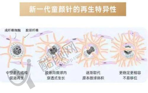 唐山金荣整形医院吴金芳院长做假体隆鼻价格8000元起，个性化设计塑造自然美鼻 