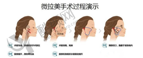 邯郸卫校附属医院皮肤科就诊体验与实例