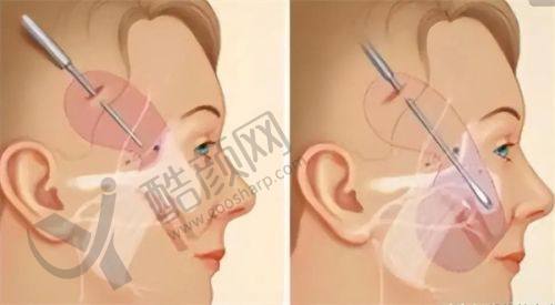 成都八大处刘珍君医生的真实患者评价如下：