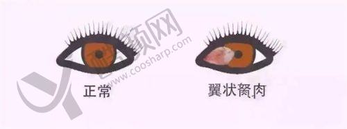 深圳爱尔眼科医院的其他优势