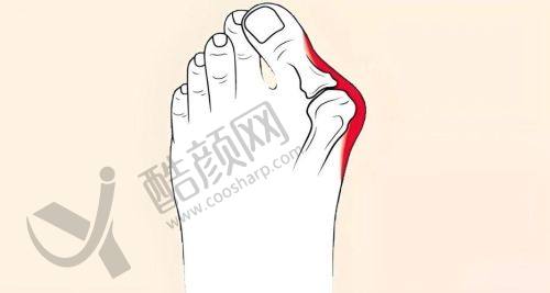 三、重庆骑士医院大脚骨科医生介绍