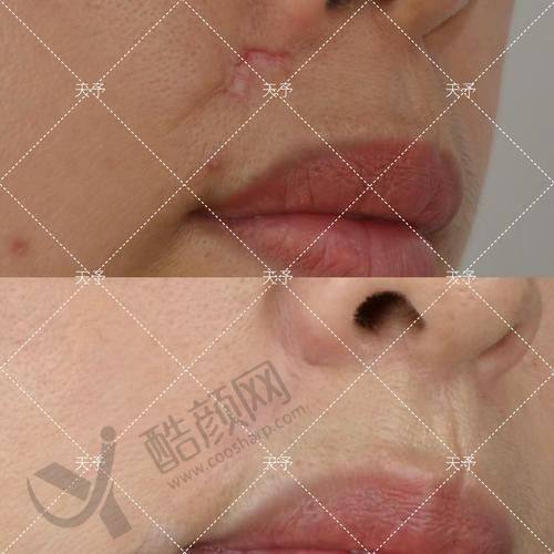 一、重庆骑士医院疤痕科怎么样？