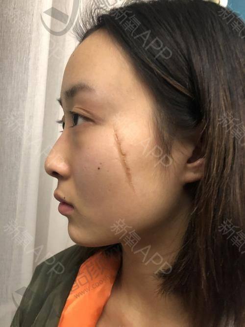 四、重庆骑士医院疤痕科怎么预约：