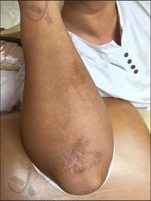 二、重庆骑士医院疤痕科正规吗？来看看医院资质：