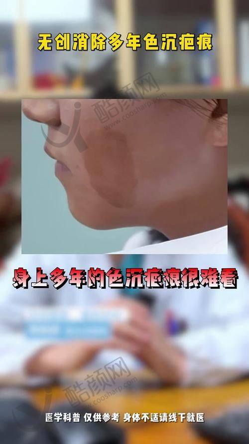 三、重庆骑士医院疤痕科基本信息：