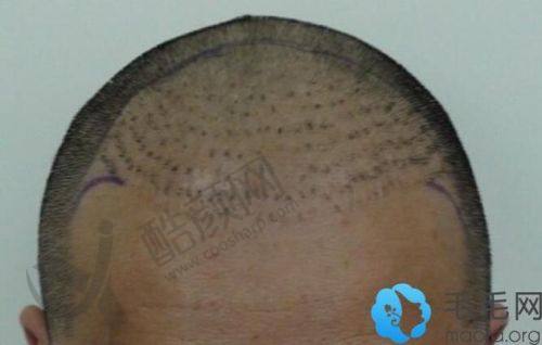 二、重庆骑士医院植发科正规吗？来看看医院资质：
