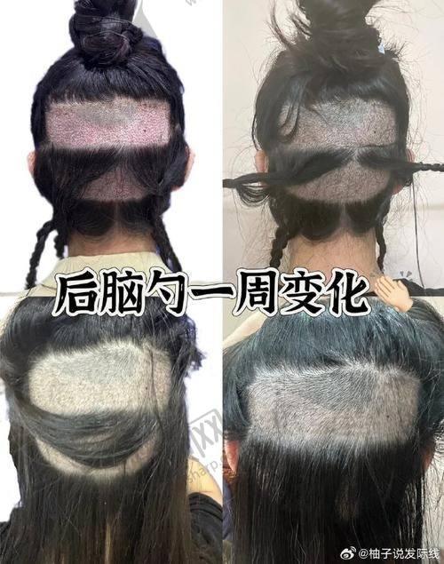 四、重庆骑士医院植发科基本信息：