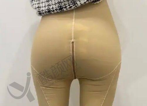 深圳美莱医疗美容：综合实力强，精细去眼袋