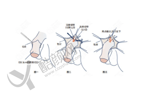 东莞晗悦医疗美容门诊部：鼻整形领域的佼佼者