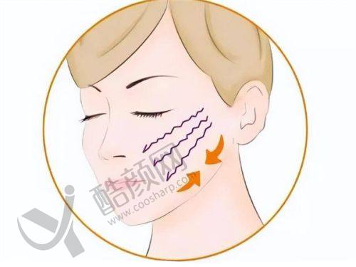 北京7d聚拉提哪个医院做得好？排名前五医院优势、价格及抗衰要点揭秘