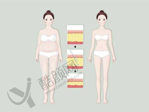 东莞缔美美容医院：性价比与技术并存