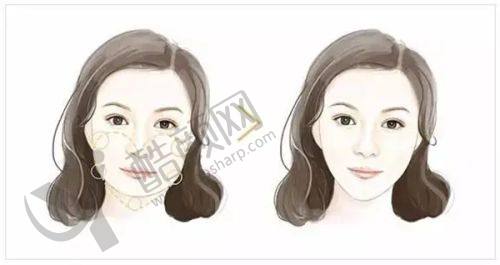 西安艺星医疗美容医院的口碑评价