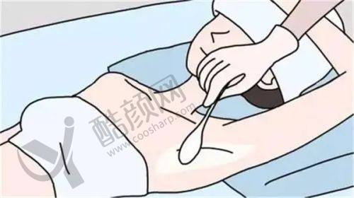 深圳艺星医疗美容：优质服务与技术，打造眼部之美