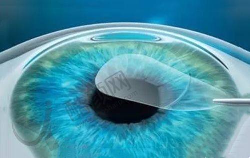 七、郑州中视眼科医院真实的患者评价如下：