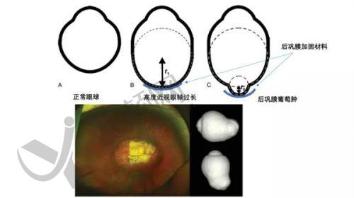 七、大连爱尔眼科医院真实的患者评价如下：