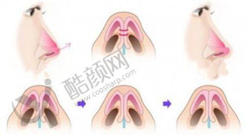 总结:四川成都友谊医院整形项目值得选择