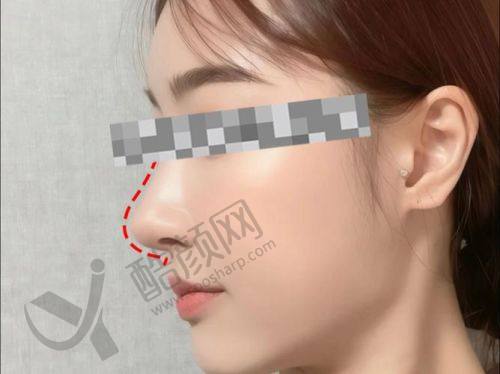 重庆当代整形外科医院肖文明医生的真实患者评价如下：
