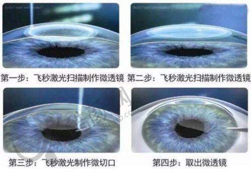北京熙仁眼科医院的其他优点