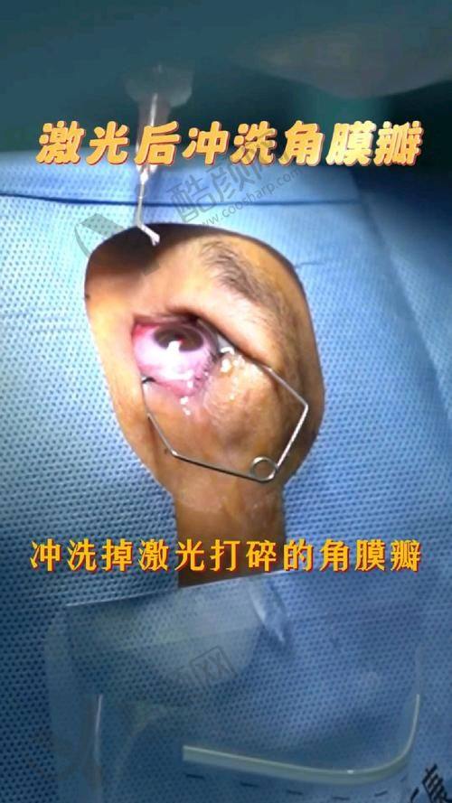 深圳佰视佳眼科具体信息介绍
