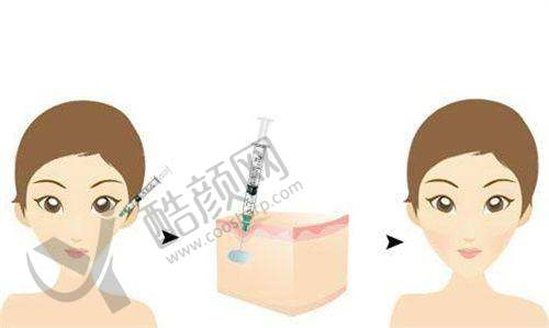 淄博壹美整形美容医院:个性化定制眼部之美
